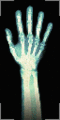 Xray hand.gif